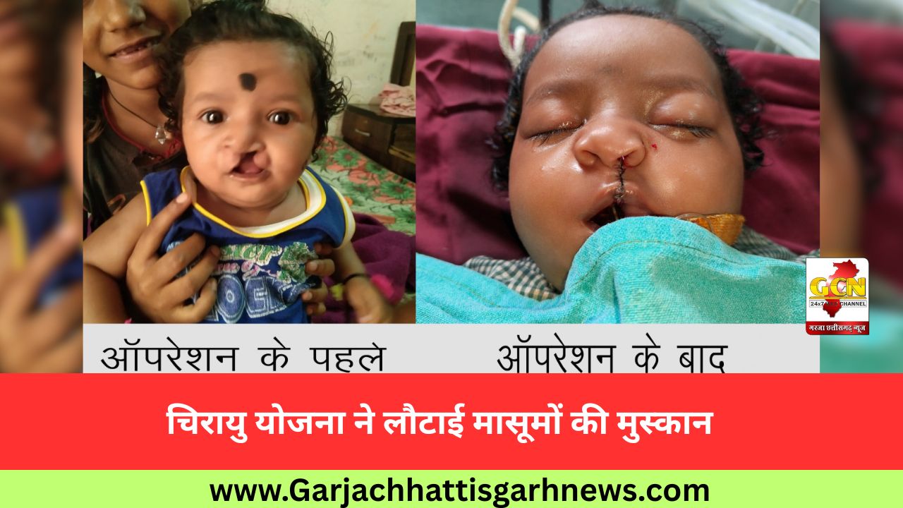 चिरायु योजना ने लौटाई मासूमों की मुस्कान