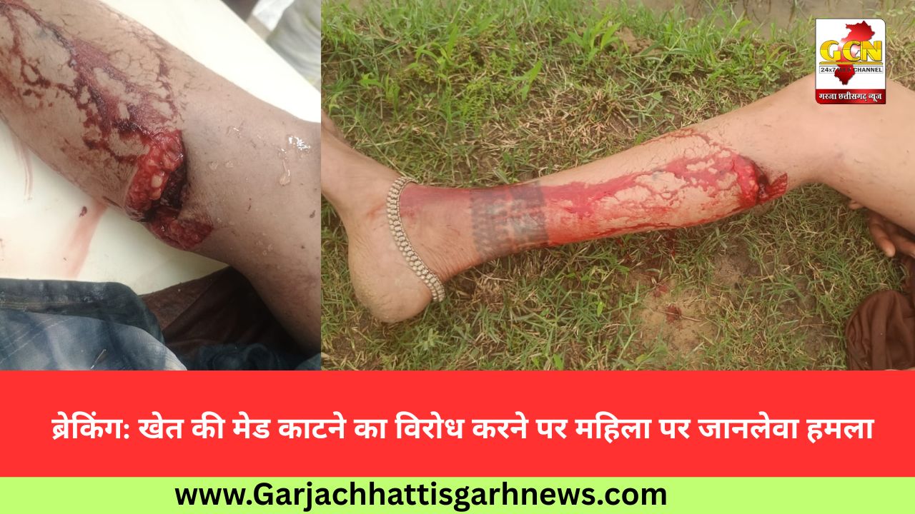 ब्रेकिंग: खेत की मेड काटने का विरोध करने पर महिला पर जानलेवा हमला